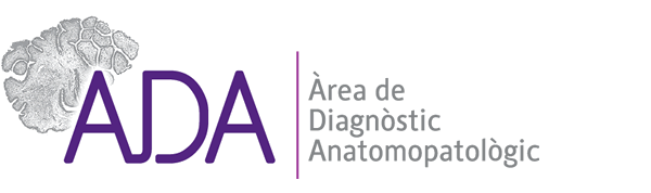 ADA » Àrea de diagnòstic Anatomopatològic » Dra. M.T. Fernández-Figueras